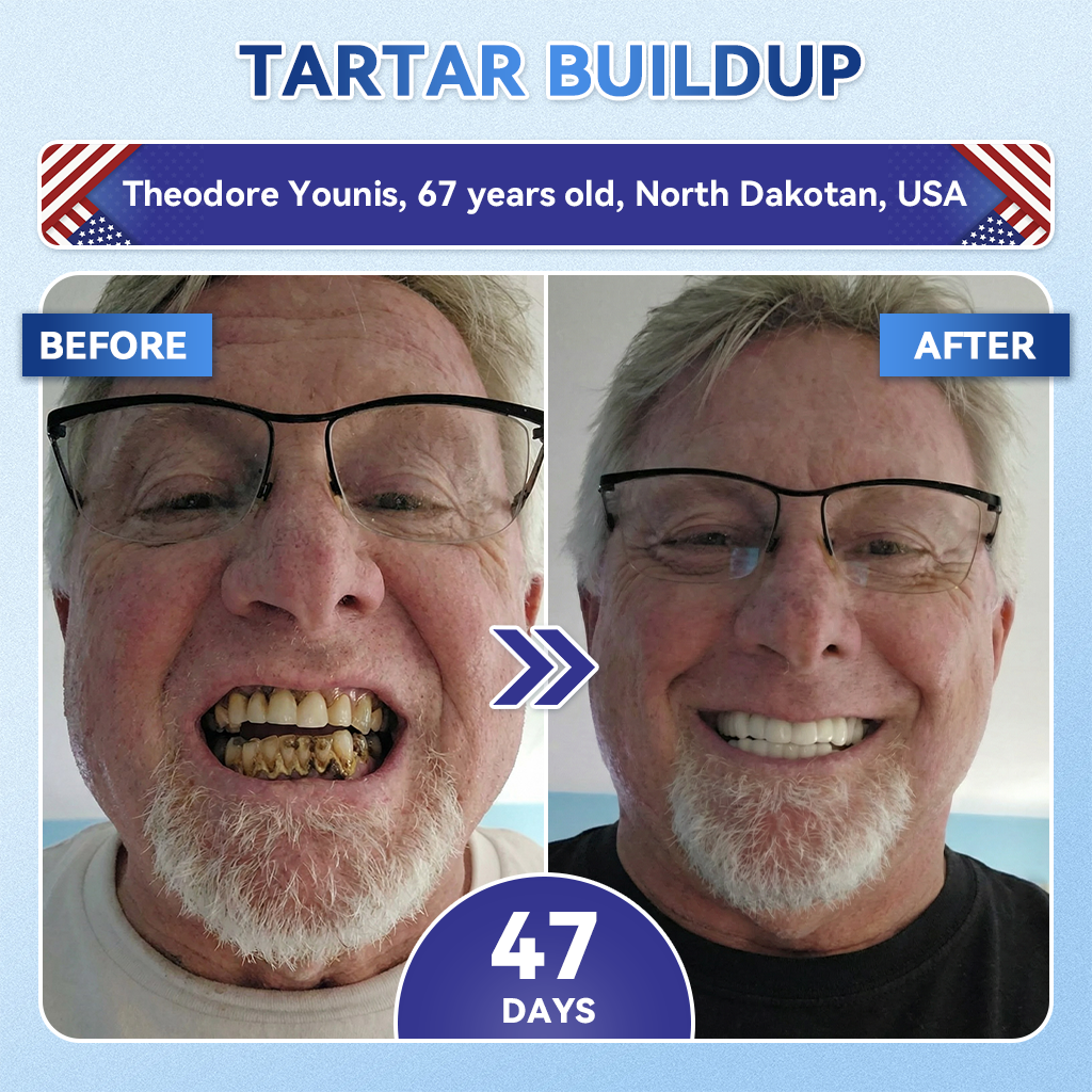 Your Smile~ Acezozla® 🦷 Tideglusib Fast‑Dissolving Tooth & Gum Repair Oral Strips ✨ (𝟓-𝐢𝐧-𝟏 💎 𝐑𝐞𝐛𝐮𝐢𝐥𝐝 𝐄𝐧𝐚𝐦𝐞𝐥 & 𝐃𝐞𝐧𝐭𝐢𝐧 • 𝐒𝐭𝐫𝐞𝐧𝐠𝐭𝐡𝐞𝐧 𝐆𝐮𝐦𝐬 • 𝐄𝐫𝐚𝐝𝐢𝐜𝐚𝐭𝐞 𝐓𝐚𝐫𝐭𝐚𝐫 & 𝐎𝐝𝐨𝐫 • 𝐖𝐡𝐢𝐭𝐞𝐧𝐢𝐧𝐠 • 𝐒𝐭𝐨𝐩 𝐓𝐨𝐨𝐭𝐡 𝐒𝐞𝐧𝐬𝐢𝐭𝐢𝐯𝐢𝐭𝐲)