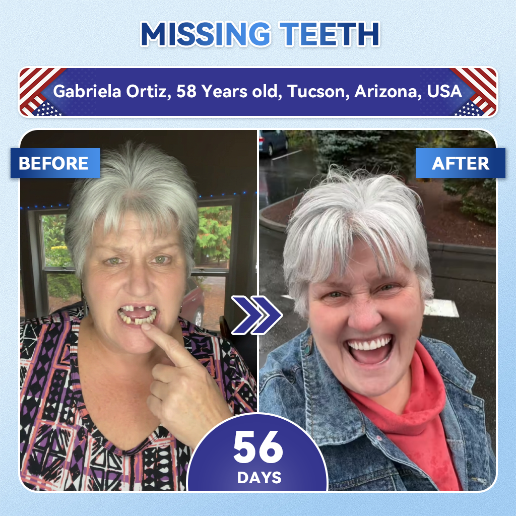 Your Smile~ Acezozla® 🦷 Tideglusib Fast‑Dissolving Tooth & Gum Repair Oral Strips ✨ (𝟓-𝐢𝐧-𝟏 💎 𝐑𝐞𝐛𝐮𝐢𝐥𝐝 𝐄𝐧𝐚𝐦𝐞𝐥 & 𝐃𝐞𝐧𝐭𝐢𝐧 • 𝐒𝐭𝐫𝐞𝐧𝐠𝐭𝐡𝐞𝐧 𝐆𝐮𝐦𝐬 • 𝐄𝐫𝐚𝐝𝐢𝐜𝐚𝐭𝐞 𝐓𝐚𝐫𝐭𝐚𝐫 & 𝐎𝐝𝐨𝐫 • 𝐖𝐡𝐢𝐭𝐞𝐧𝐢𝐧𝐠 • 𝐒𝐭𝐨𝐩 𝐓𝐨𝐨𝐭𝐡 𝐒𝐞𝐧𝐬𝐢𝐭𝐢𝐯𝐢𝐭𝐲)