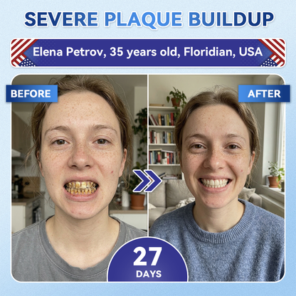 Your Smile~ Acezozla® 🦷 Tideglusib Fast‑Dissolving Tooth & Gum Repair Oral Strips ✨ (𝟓-𝐢𝐧-𝟏 💎 𝐑𝐞𝐛𝐮𝐢𝐥𝐝 𝐄𝐧𝐚𝐦𝐞𝐥 & 𝐃𝐞𝐧𝐭𝐢𝐧 • 𝐒𝐭𝐫𝐞𝐧𝐠𝐭𝐡𝐞𝐧 𝐆𝐮𝐦𝐬 • 𝐄𝐫𝐚𝐝𝐢𝐜𝐚𝐭𝐞 𝐓𝐚𝐫𝐭𝐚𝐫 & 𝐎𝐝𝐨𝐫 • 𝐖𝐡𝐢𝐭𝐞𝐧𝐢𝐧𝐠 • 𝐒𝐭𝐨𝐩 𝐓𝐨𝐨𝐭𝐡 𝐒𝐞𝐧𝐬𝐢𝐭𝐢𝐯𝐢𝐭𝐲)
