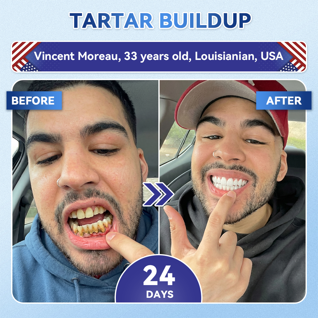 Your Smile~ Acezozla® 🦷 Tideglusib Fast‑Dissolving Tooth & Gum Repair Oral Strips ✨ (𝟓-𝐢𝐧-𝟏 💎 𝐑𝐞𝐛𝐮𝐢𝐥𝐝 𝐄𝐧𝐚𝐦𝐞𝐥 & 𝐃𝐞𝐧𝐭𝐢𝐧 • 𝐒𝐭𝐫𝐞𝐧𝐠𝐭𝐡𝐞𝐧 𝐆𝐮𝐦𝐬 • 𝐄𝐫𝐚𝐝𝐢𝐜𝐚𝐭𝐞 𝐓𝐚𝐫𝐭𝐚𝐫 & 𝐎𝐝𝐨𝐫 • 𝐖𝐡𝐢𝐭𝐞𝐧𝐢𝐧𝐠 • 𝐒𝐭𝐨𝐩 𝐓𝐨𝐨𝐭𝐡 𝐒𝐞𝐧𝐬𝐢𝐭𝐢𝐯𝐢𝐭𝐲)