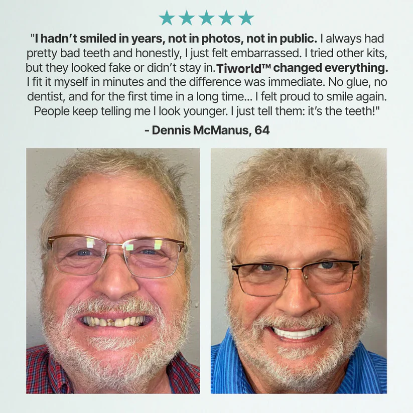 ✨Ends Today: 70% OFF! Ptyalial™⏰ Custom-Fit Full Functional Dentures Make you more confident