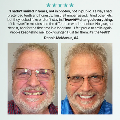 ✨Ends Today: 70% OFF! Ptyalial™⏰ Custom-Fit Full Functional Dentures Make you more confident