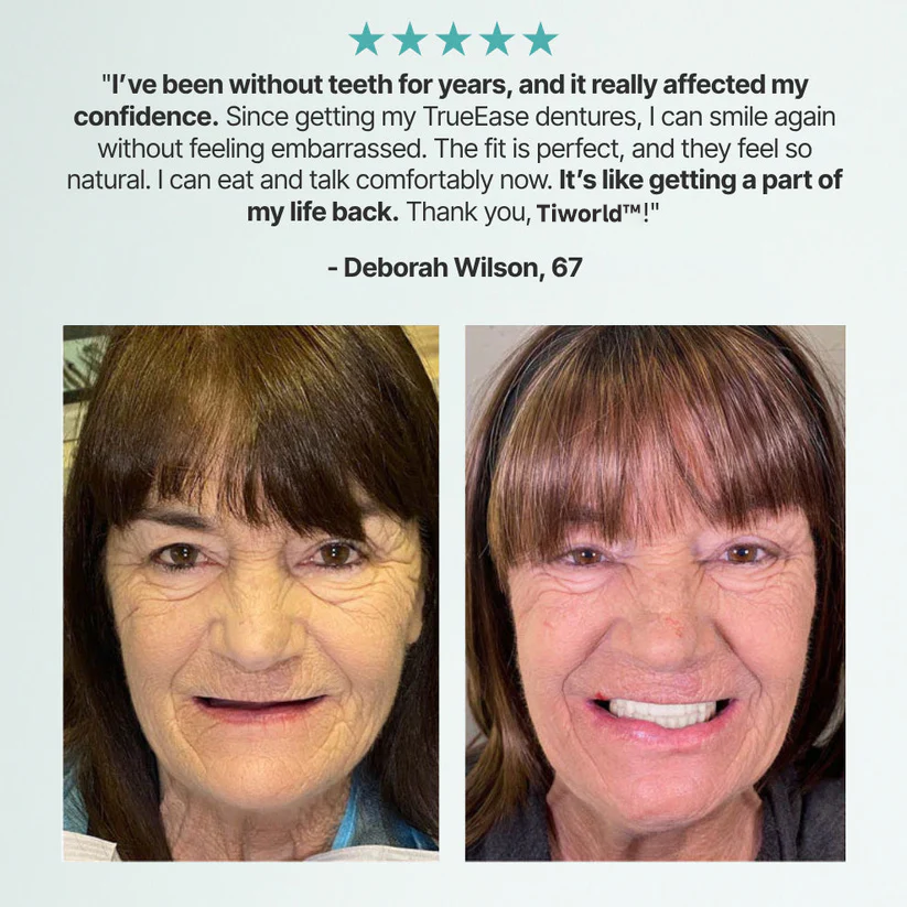 ✨Ends Today: 70% OFF! Ptyalial™⏰ Custom-Fit Full Functional Dentures Make you more confident